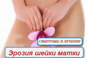 eroziy-scheiki-matki-seo